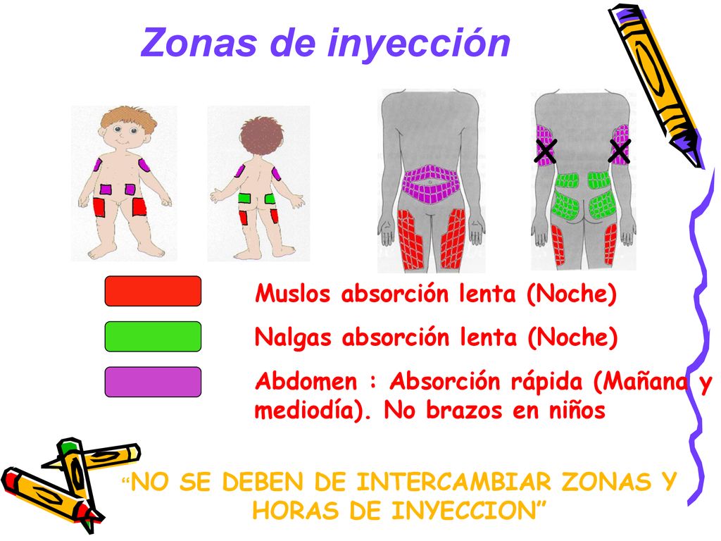 NO SE DEBEN DE INTERCAMBIAR ZONAS Y HORAS DE INYECCION