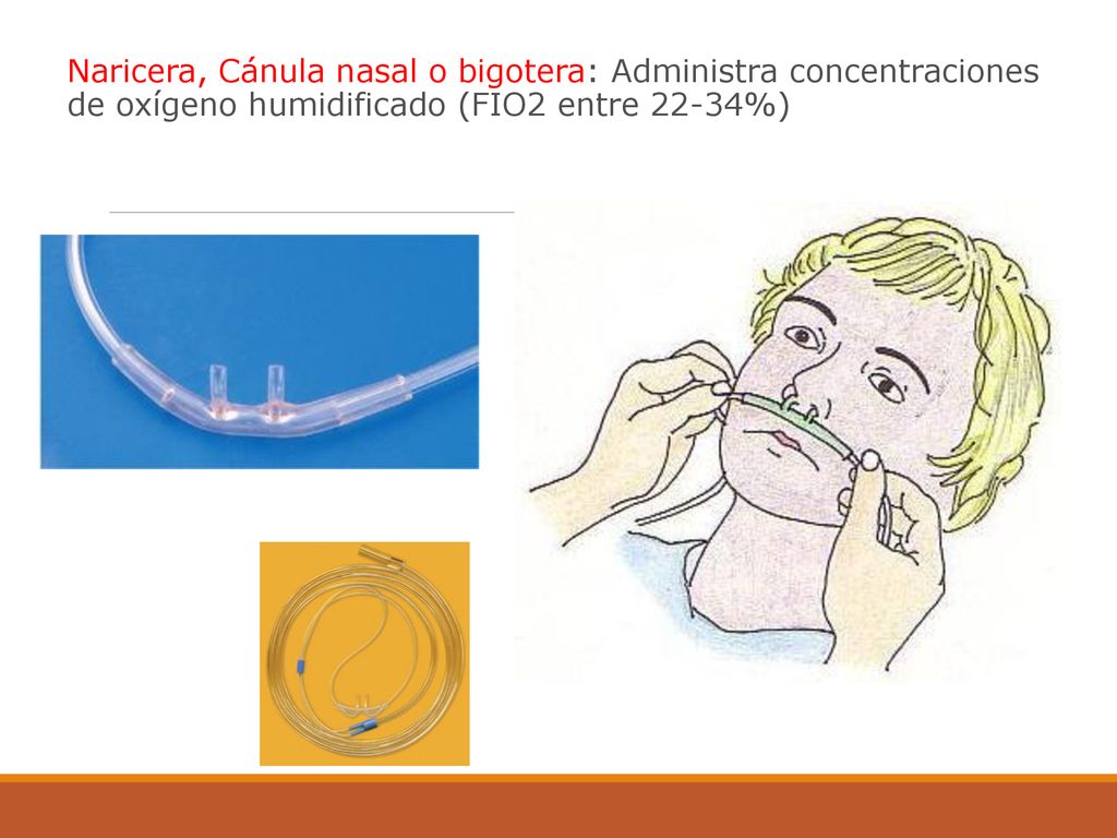 Naricera, Cánula nasal o bigotera: Administra concentraciones de oxígeno humidificado (FIO2 entre 22-34%)