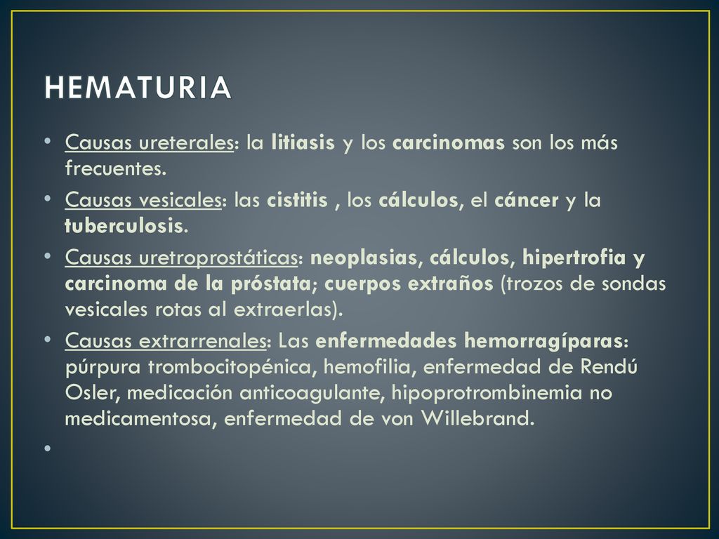HEMATURIA Causas ureterales: la litiasis y los carcinomas son los más frecuentes.