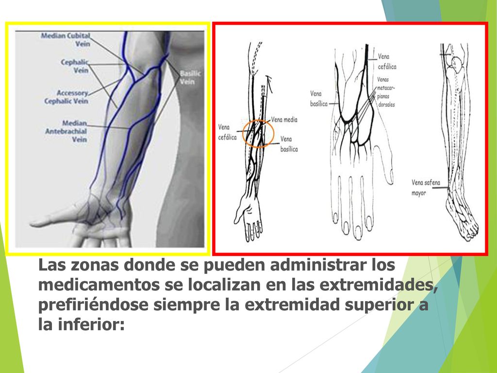 Las zonas donde se pueden administrar los medicamentos se localizan en las extremidades, prefiriéndose siempre la extremidad superior a la inferior: