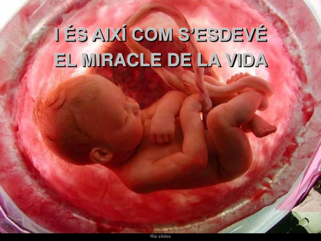 I ÉS AIXÍ COM S’ESDEVÉ EL MIRACLE DE LA VIDA