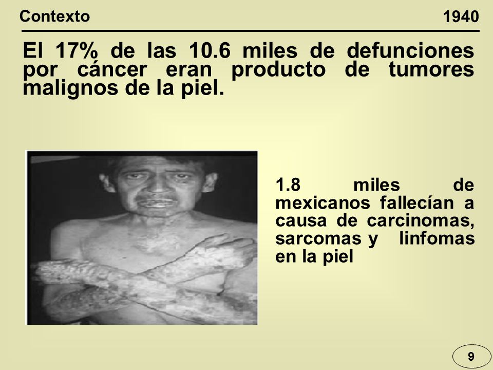 Contexto El 17% de las 10.6 miles de defunciones por cáncer eran producto de tumores malignos de la piel.
