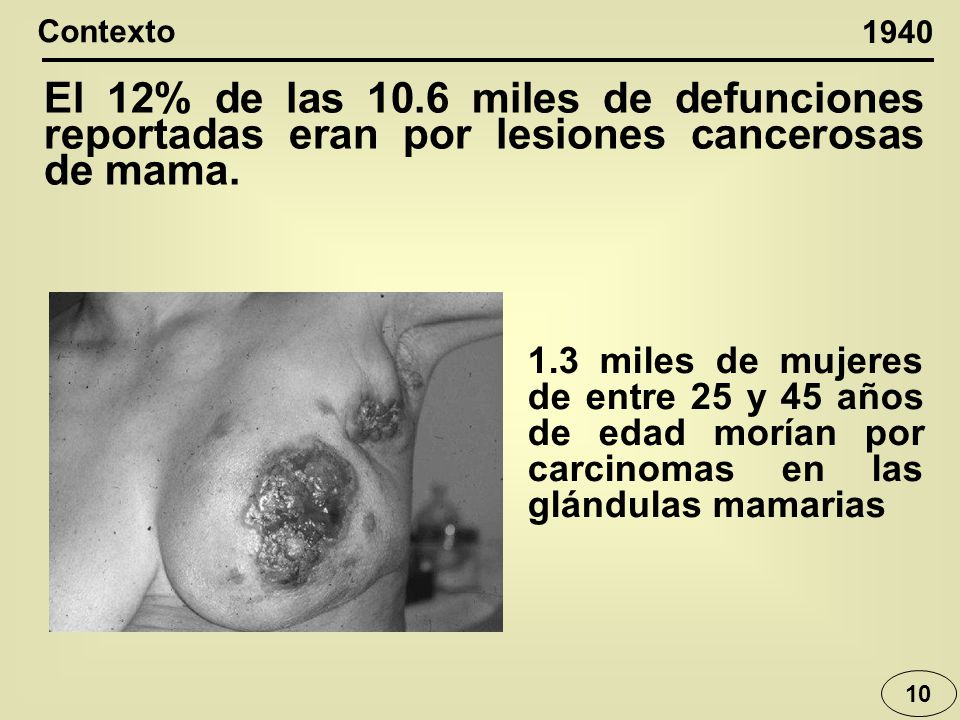 Contexto El 12% de las 10.6 miles de defunciones reportadas eran por lesiones cancerosas de mama.