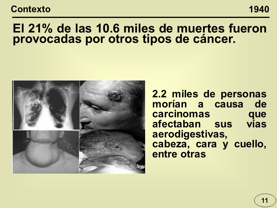 Contexto El 21% de las 10.6 miles de muertes fueron provocadas por otros tipos de cáncer.