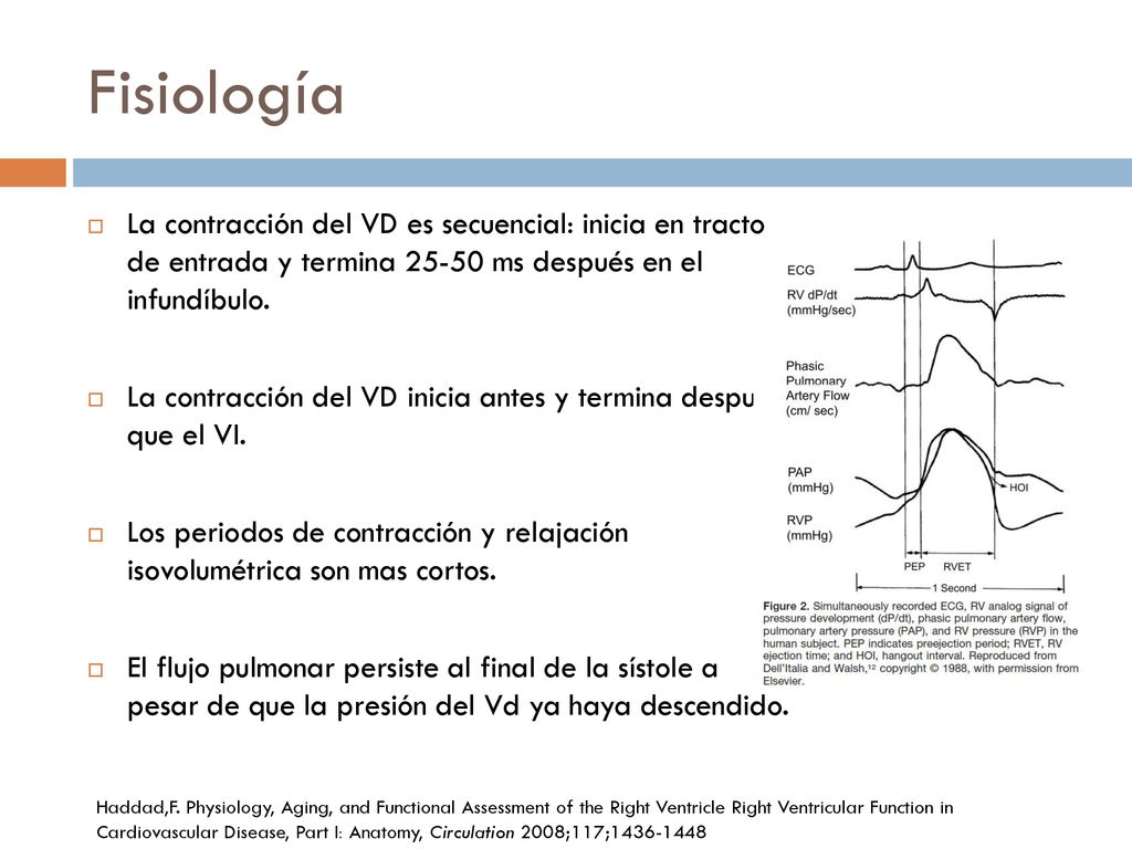 Fisiología La contracción del VD es secuencial: inicia en tracto de entrada y termina ms después en el infundíbulo.