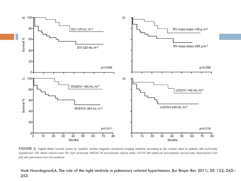 Vonk Noordegraaf,A. The role of the right ventricle in pulmonary arterial hypertension.