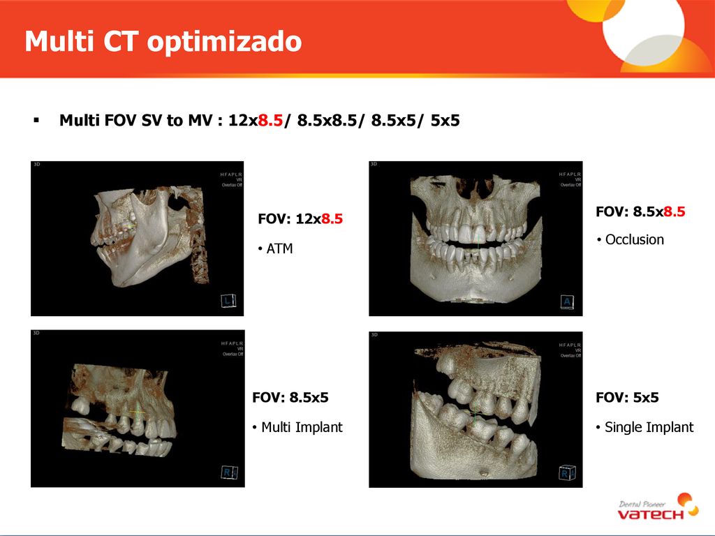 Multi CT optimizado Multi FOV SV to MV : 12x8.5/ 8.5x8.5/ 8.5x5/ 5x5