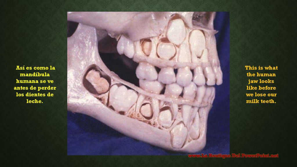 This is what the human jaw looks like before we lose our milk teeth.