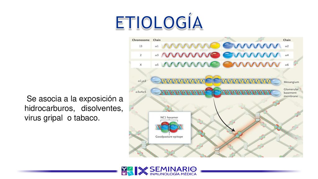 ETIOLOGÍA Se asocia a la exposición a hidrocarburos, disolventes, virus gripal o tabaco.