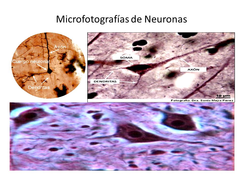 Microfotografías de Neuronas
