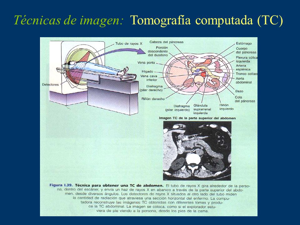 Técnicas de imagen: Tomografía computada (TC)