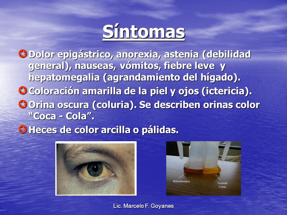 Síntomas Dolor epigástrico, anorexia, astenia (debilidad general), nauseas, vómitos, fiebre leve y hepatomegalia (agrandamiento del hígado).
