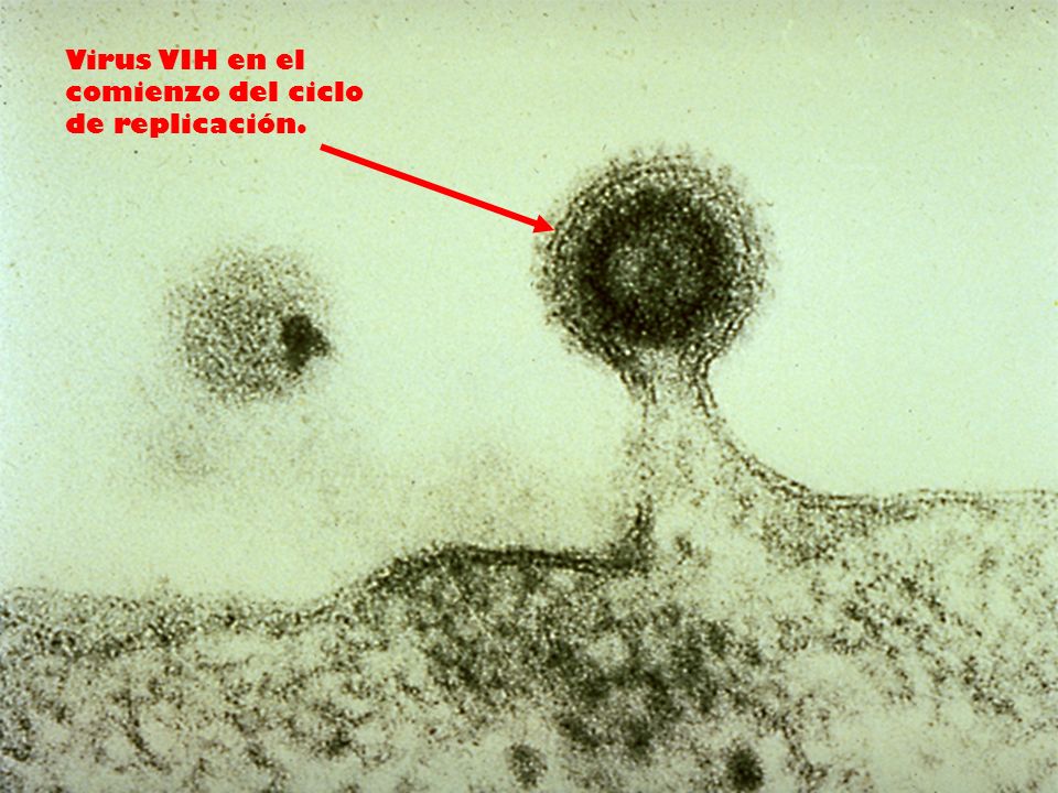 Virus VIH en el comienzo del ciclo de replicación.