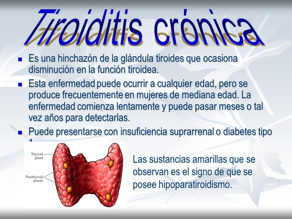 Tiroiditis crónica Es una hinchazón de la glándula tiroides que ocasiona disminución en la función tiroidea.