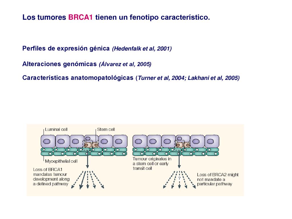Los tumores BRCA1 tienen un fenotipo característico.