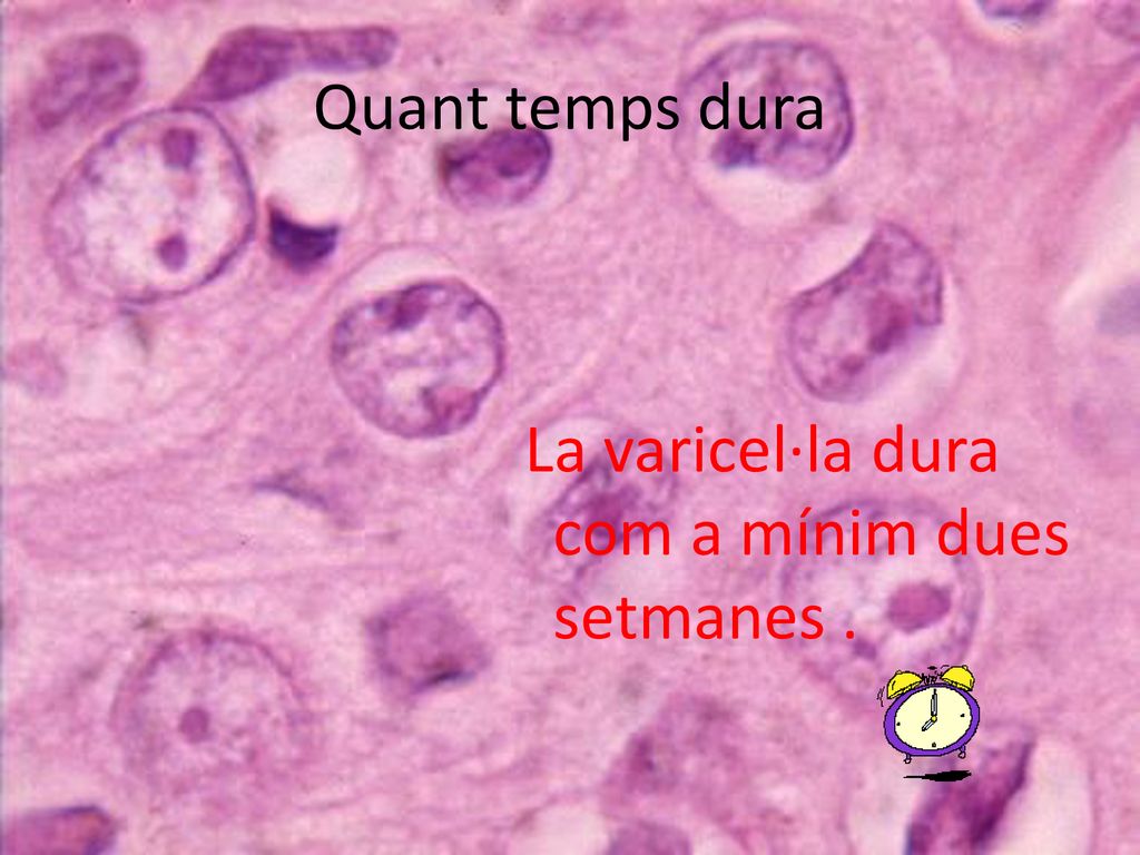 Quant temps dura La varicel·la dura com a mínim dues setmanes .