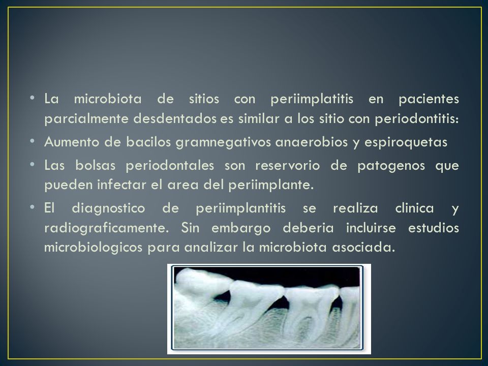 La microbiota de sitios con periimplatitis en pacientes parcialmente desdentados es similar a los sitio con periodontitis: