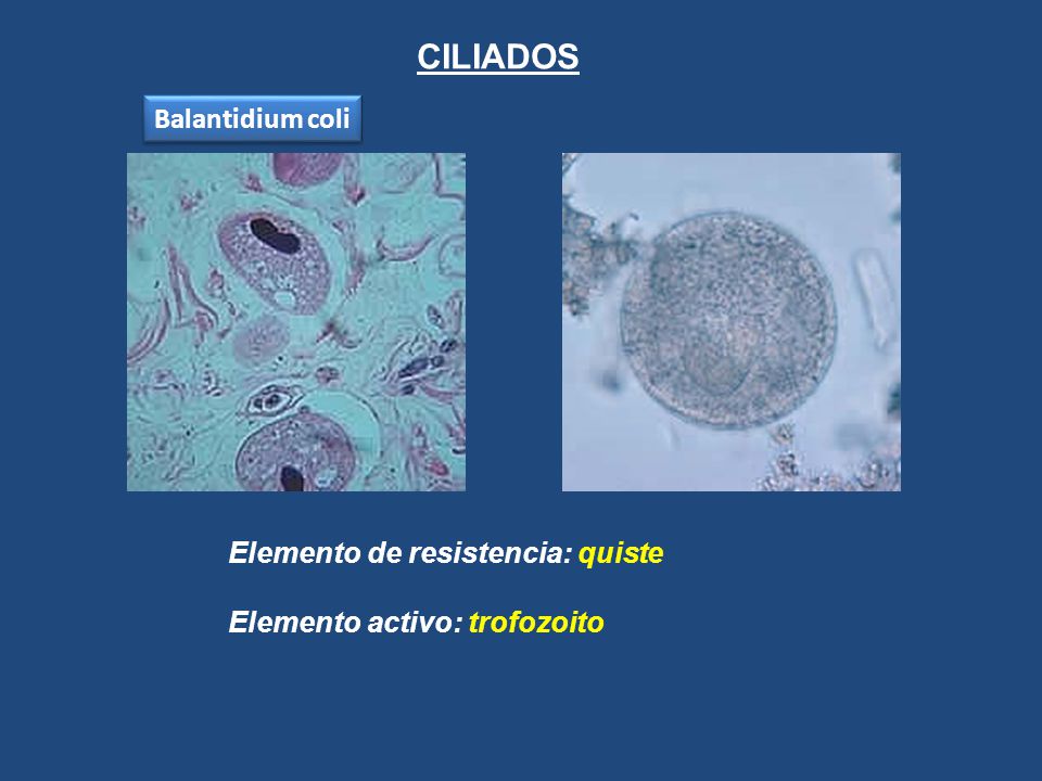 CILIADOS Balantidium coli Elemento de resistencia: quiste