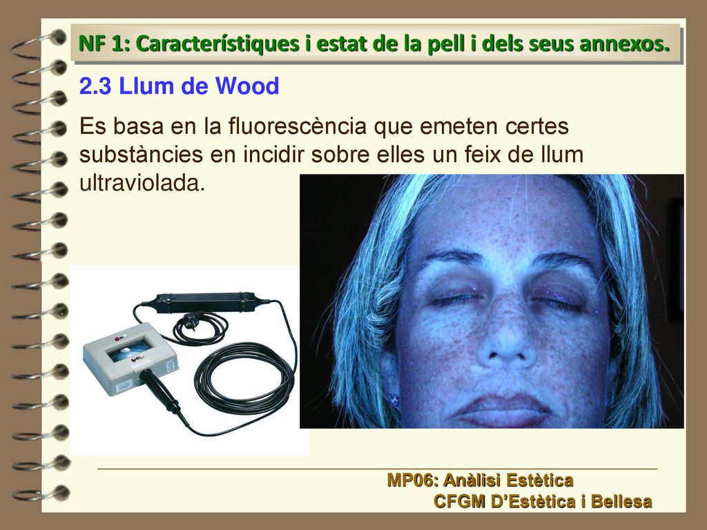 NF 1: Característiques i estat de la pell i dels seus annexos.