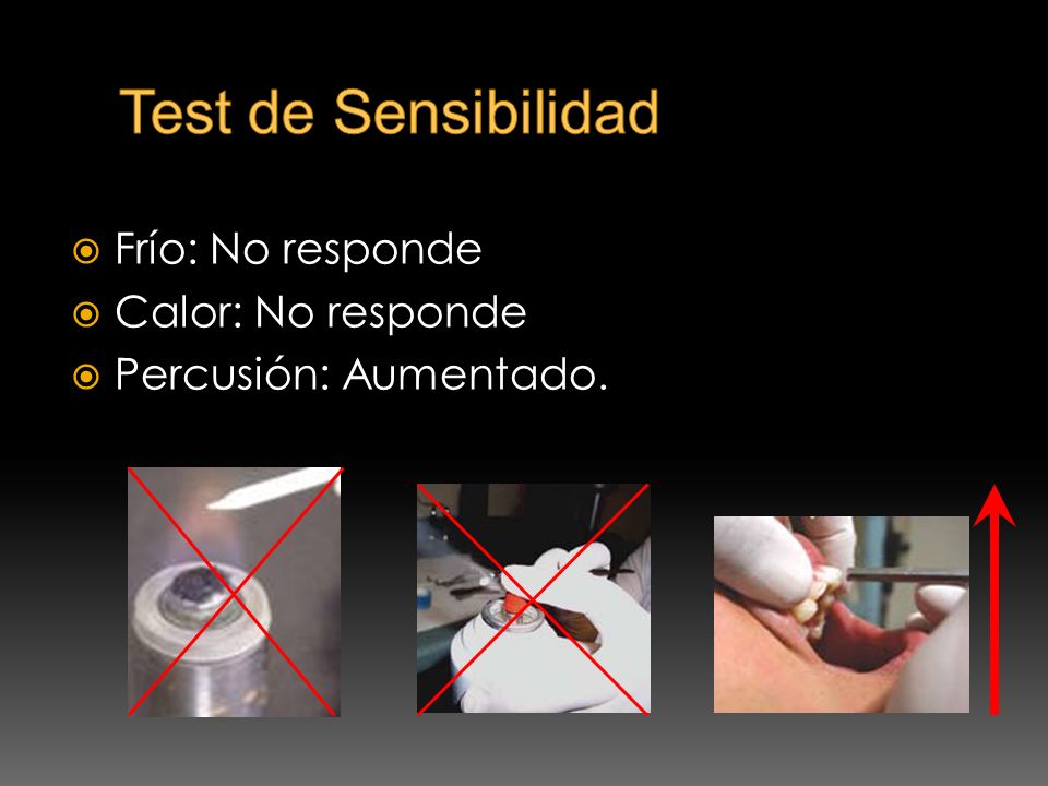 Test de Sensibilidad Frío: No responde Calor: No responde
