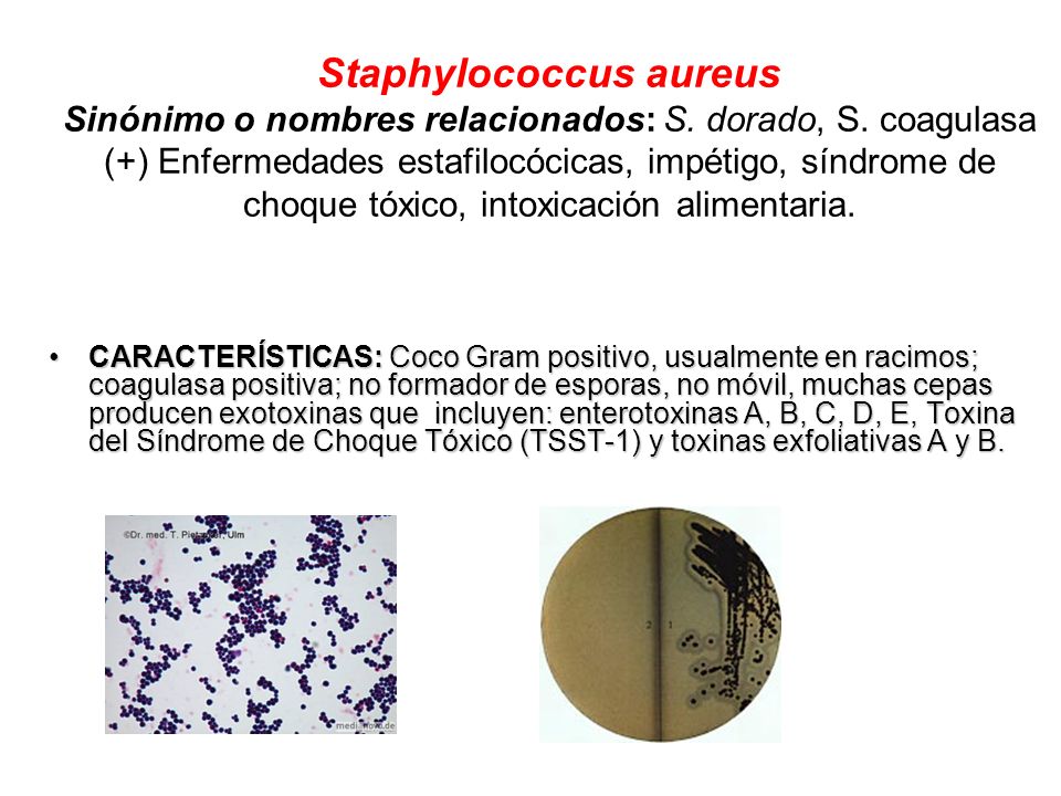 Staphylococcus aureus Sinónimo o nombres relacionados: S. dorado, S