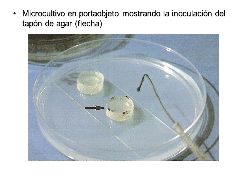 Microcultivo en portaobjeto mostrando la inoculación del tapón de agar (flecha)