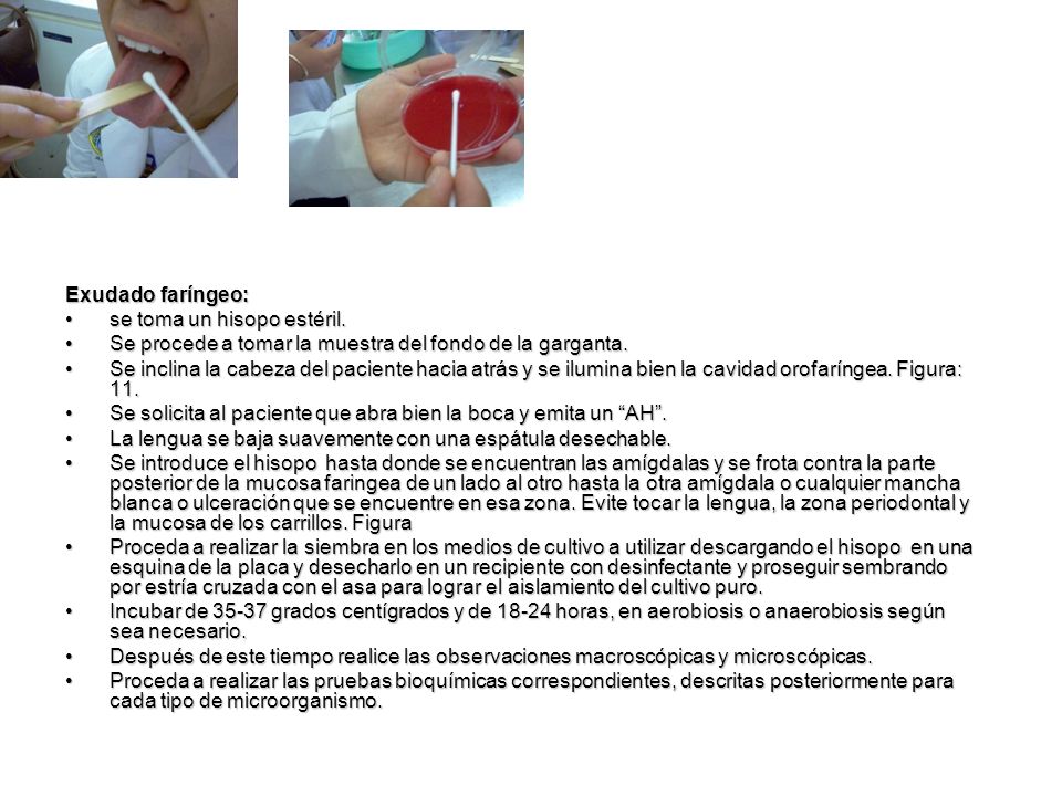 Exudado faríngeo: se toma un hisopo estéril. Se procede a tomar la muestra del fondo de la garganta.