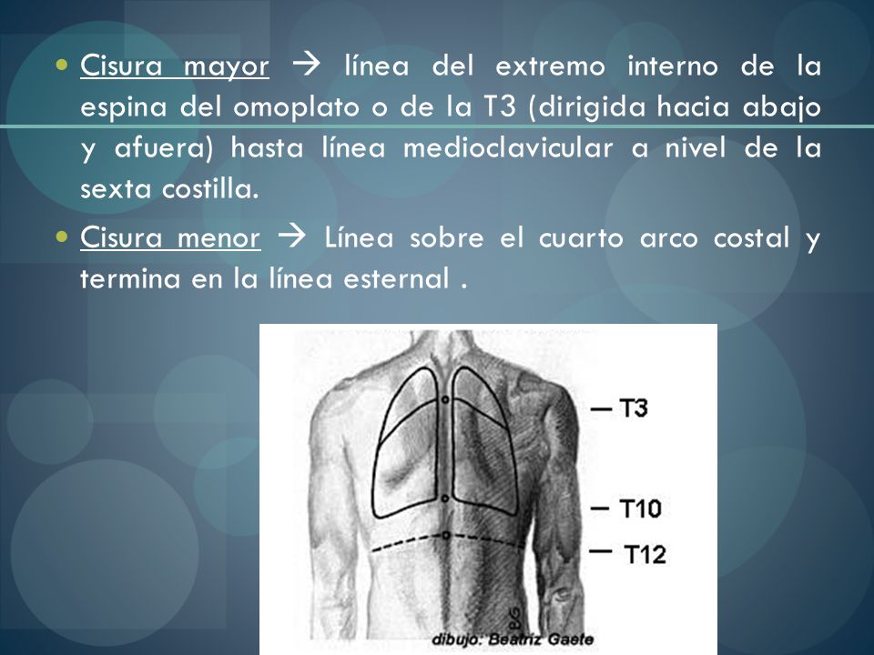Cisura mayor  línea del extremo interno de la espina del omoplato o de la T3 (dirigida hacia abajo y afuera) hasta línea medioclavicular a nivel de la sexta costilla.