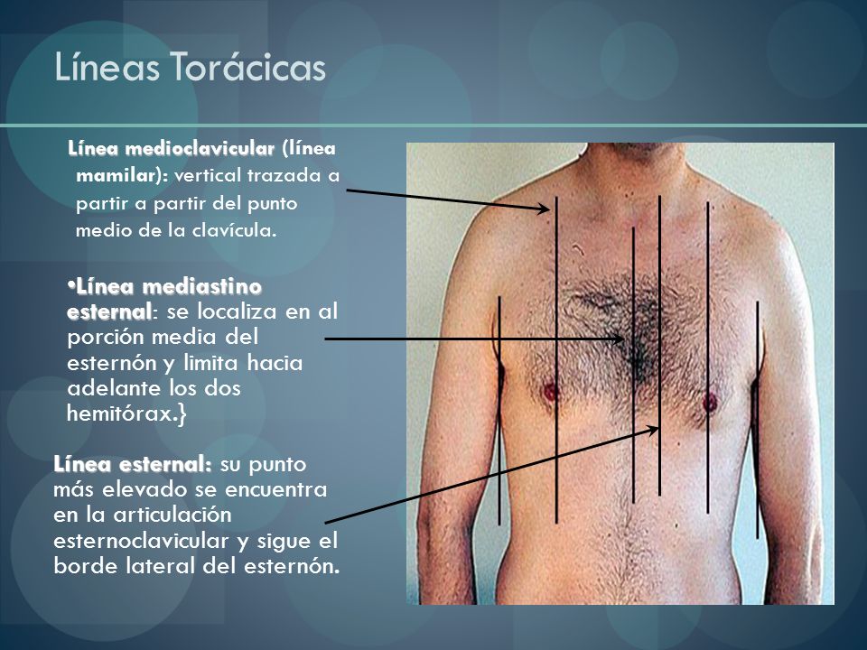 Líneas Torácicas Línea medioclavicular (línea mamilar): vertical trazada a partir a partir del punto medio de la clavícula.