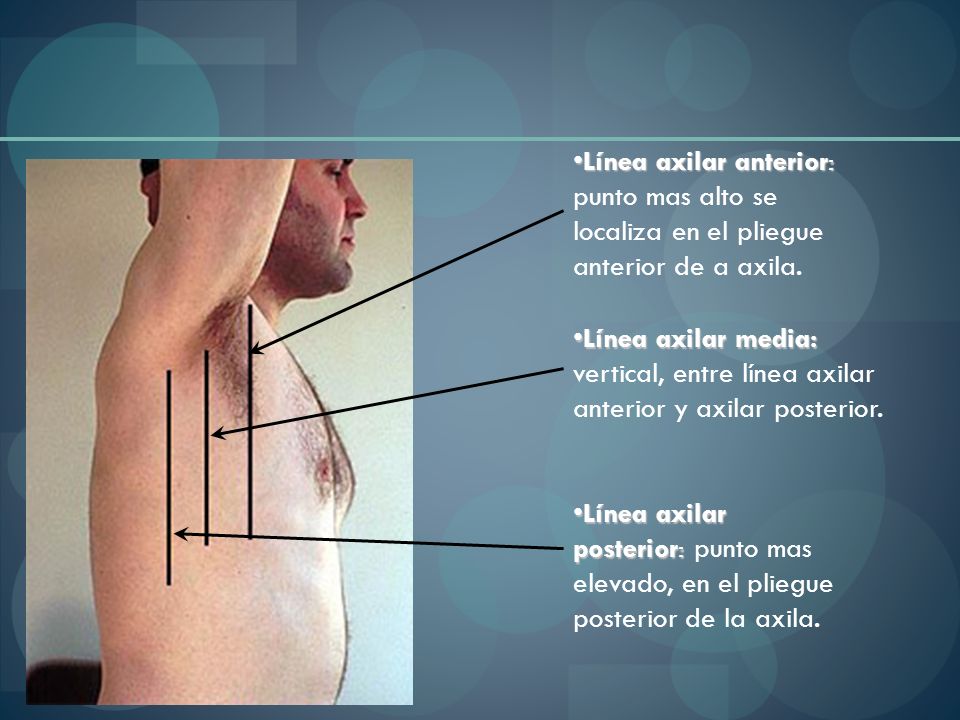 Línea axilar anterior: punto mas alto se localiza en el pliegue anterior de a axila.