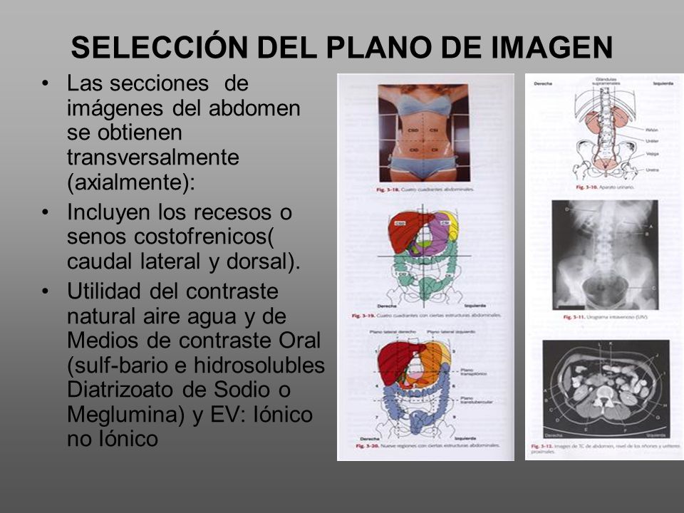 SELECCIÓN DEL PLANO DE IMAGEN