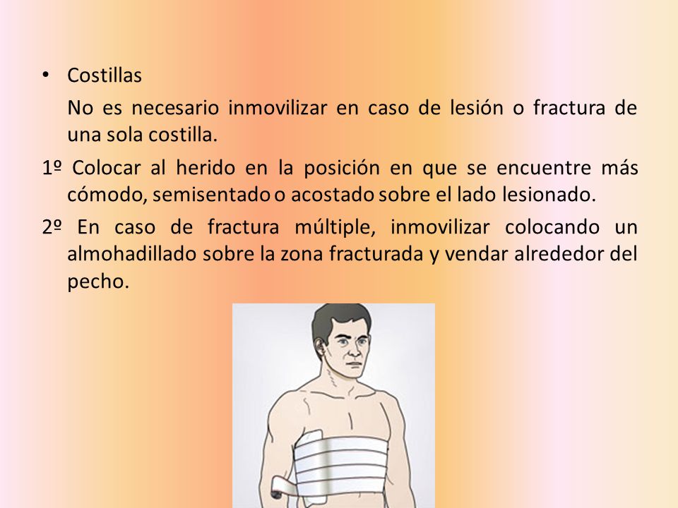 Costillas No es necesario inmovilizar en caso de lesión o fractura de una sola costilla.