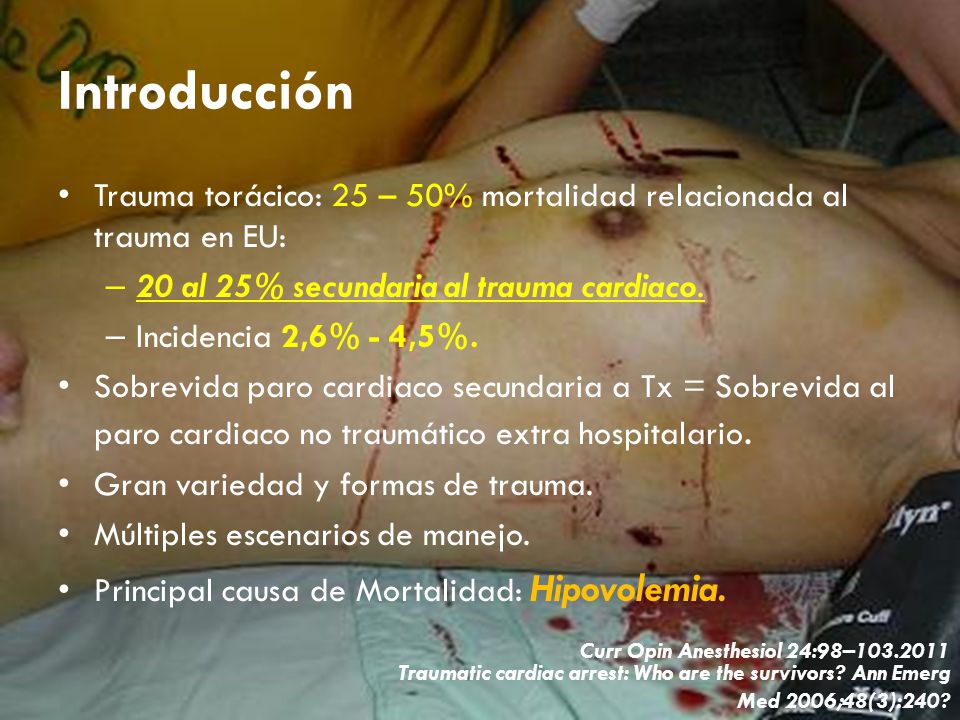 Introducción Trauma torácico: 25 – 50% mortalidad relacionada al trauma en EU: 20 al 25% secundaria al trauma cardiaco.