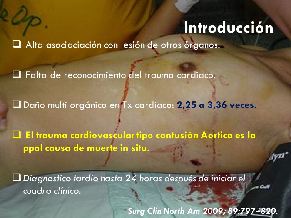 Introducción Alta asociaciación con lesión de otros órganos.