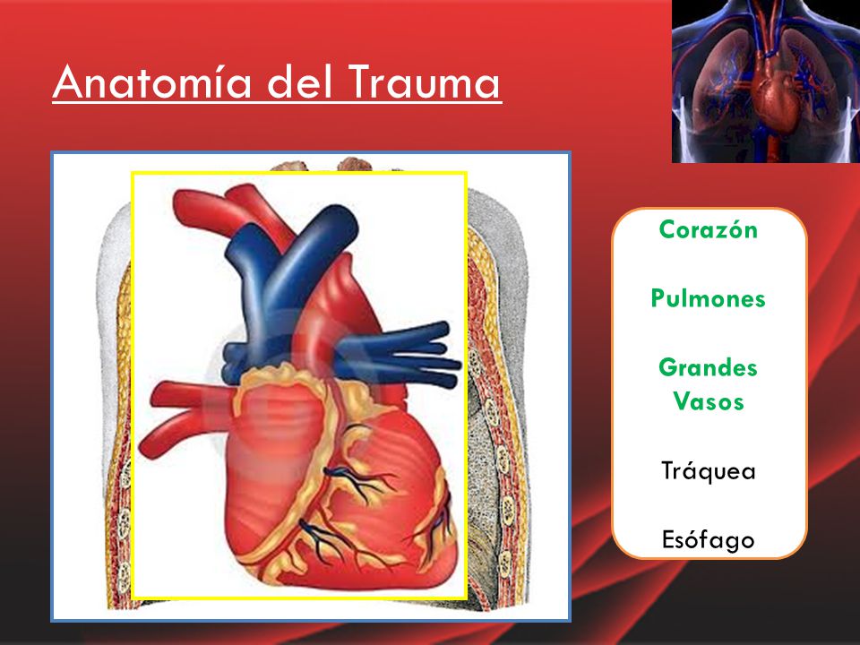 Anatomía del Trauma Corazón Pulmones Grandes Vasos Tráquea Esófago