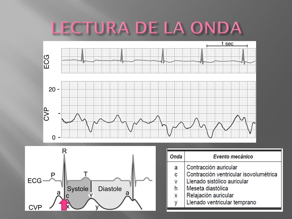 LECTURA DE LA ONDA C: cierre de la valvula tricuspidea y mvto hacia la auricula. X: posteriormente la P en auric cae.