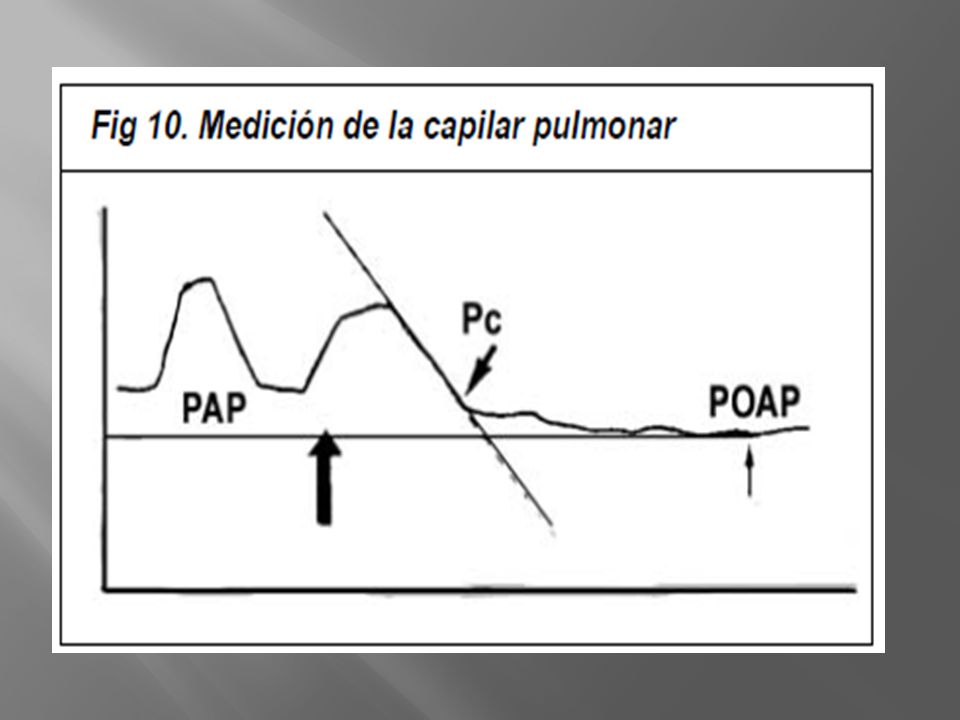 La POAP no es el único factor a tener en cuenta para la prevención del edema pulmonar. Se deben considerar además de la presión hidrostática, la permeabilidad de las membranas y la presión coloido-osmótica.