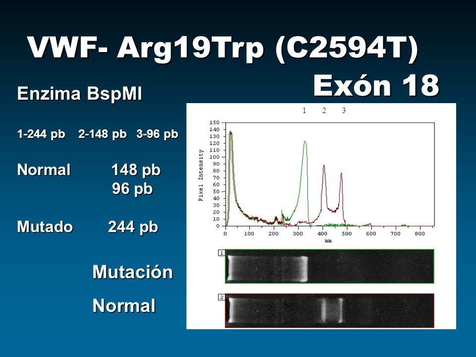 VWF- Arg19Trp (C2594T) Exón 18 Enzima BspMI Mutación Normal