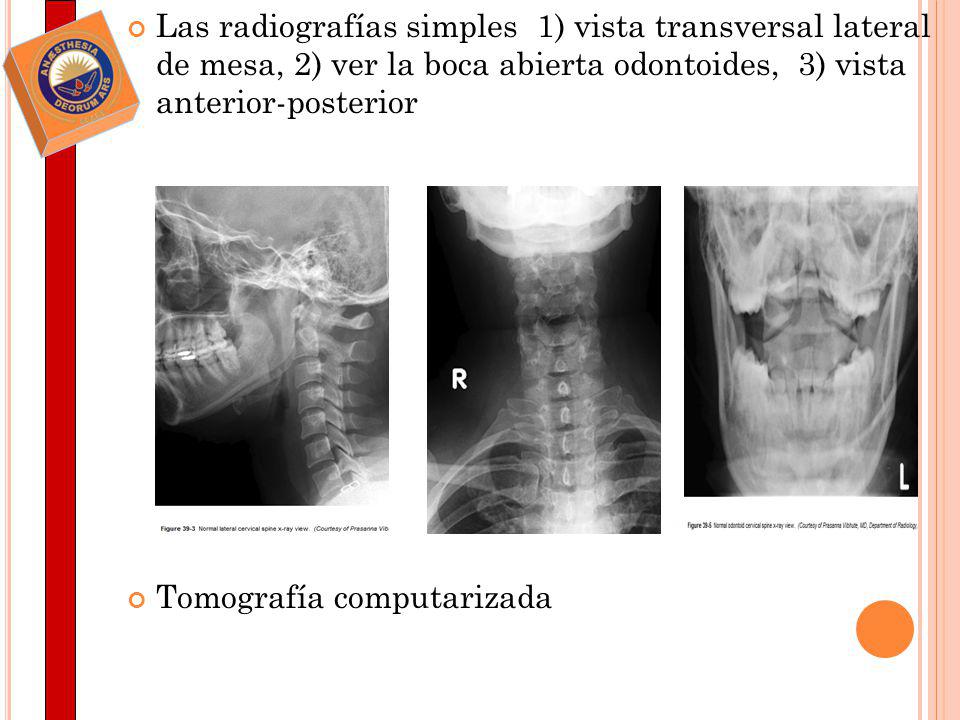 Las radiografías simples 1) vista transversal lateral de mesa, 2) ver la boca abierta odontoides, 3) vista anterior-posterior
