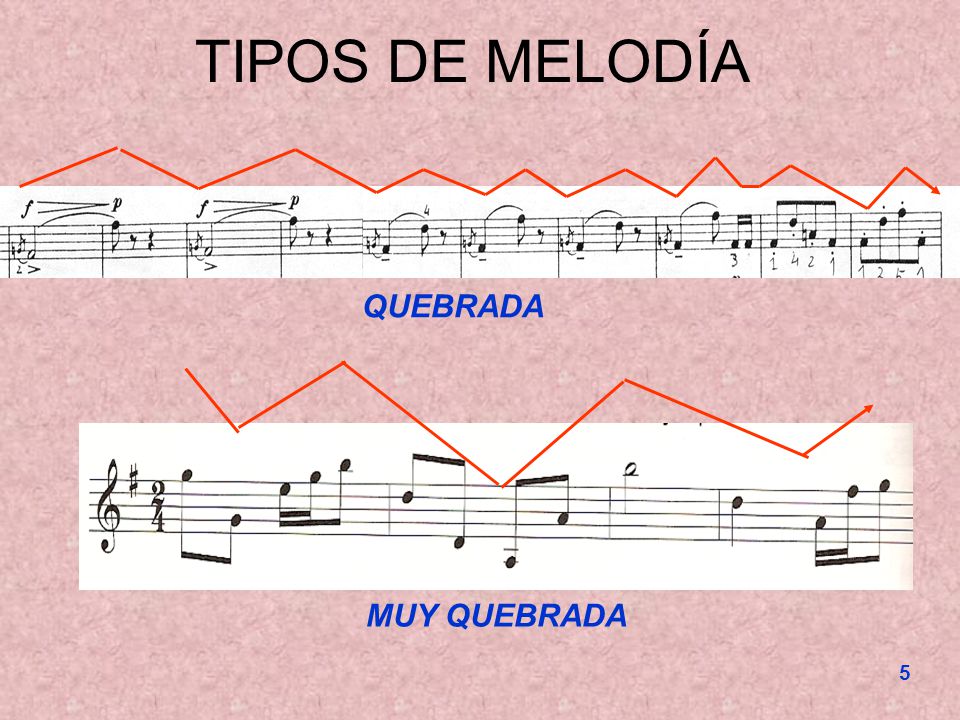 TIPOS DE MELODÍA QUEBRADA MUY QUEBRADA