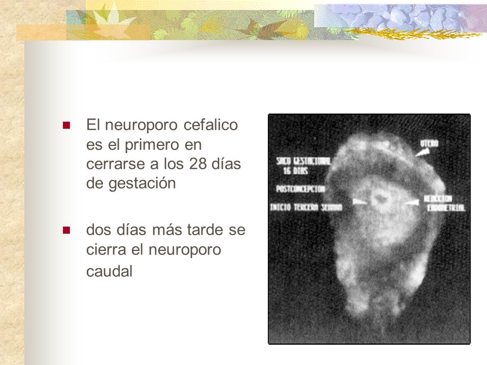 El neuroporo cefalico es el primero en cerrarse a los 28 días de gestación