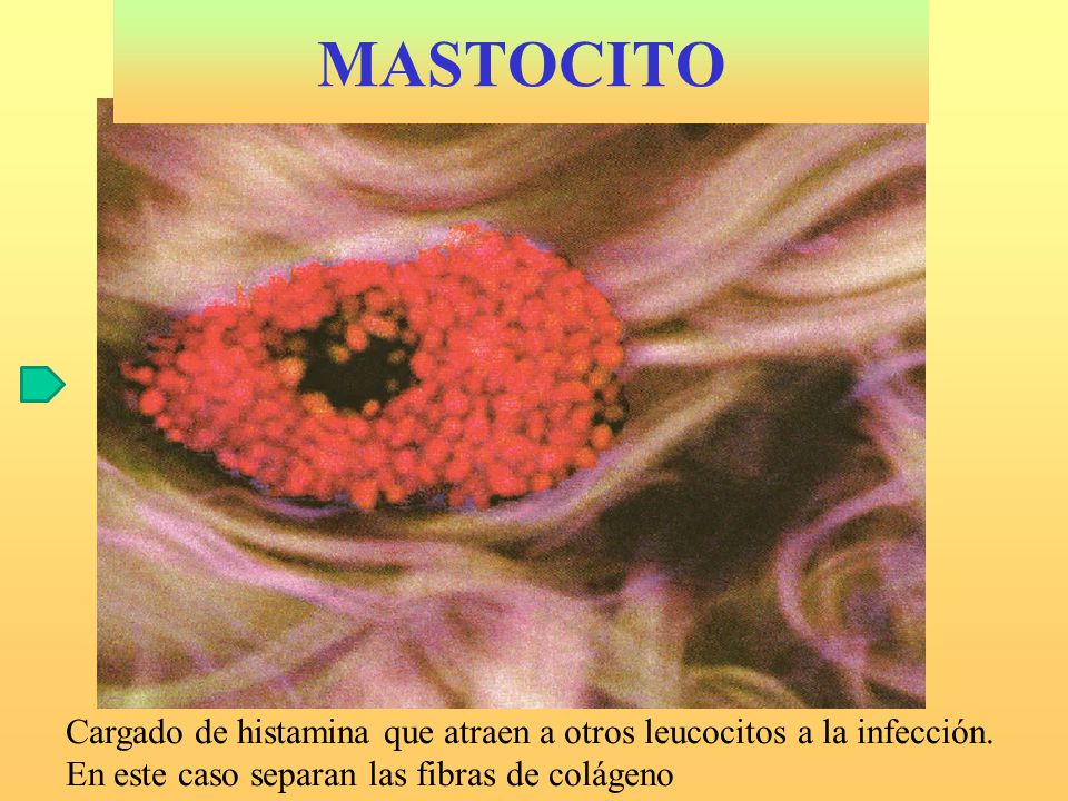 MASTOCITO Cargado de histamina que atraen a otros leucocitos a la infección.