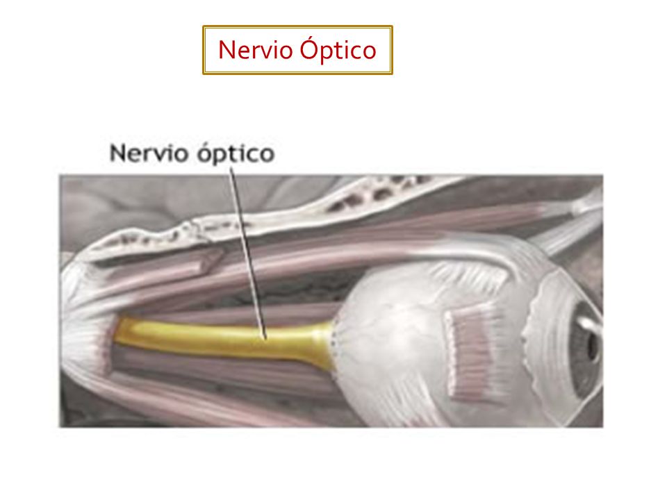 Nervio Óptico