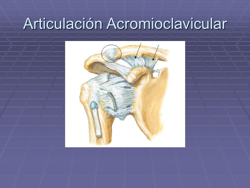 Articulación Acromioclavicular