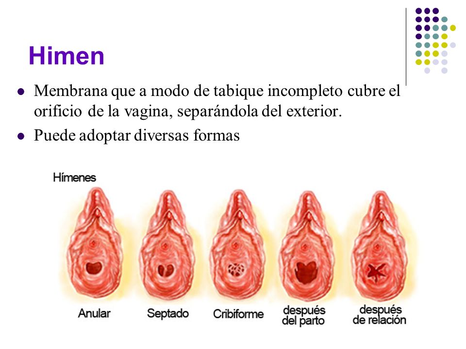 Himen Membrana que a modo de tabique incompleto cubre el orificio de la vagina, separándola del exterior.