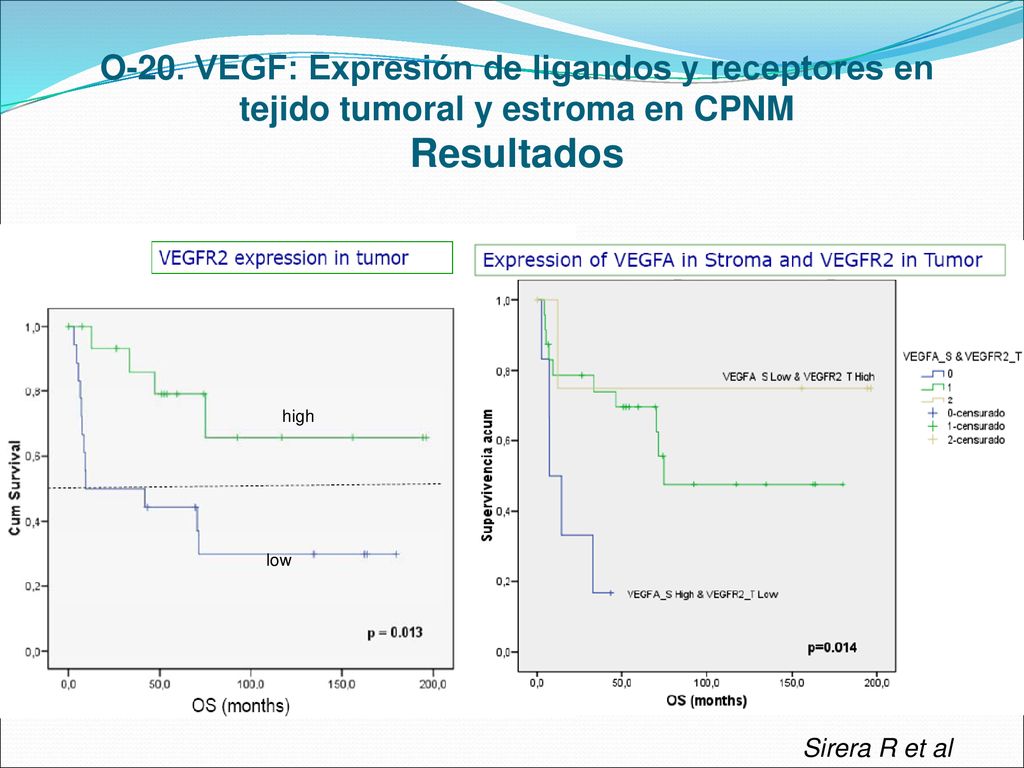 O-20. VEGF: Expresión de ligandos y receptores en tejido tumoral y estroma en CPNM Resultados