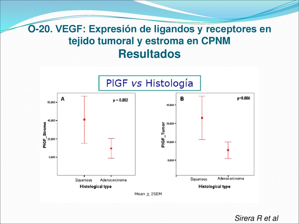 O-20. VEGF: Expresión de ligandos y receptores en tejido tumoral y estroma en CPNM Resultados
