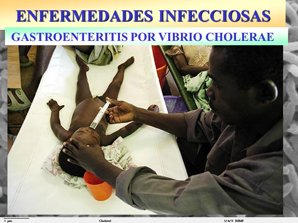 ENFERMEDADES INFECCIOSAS