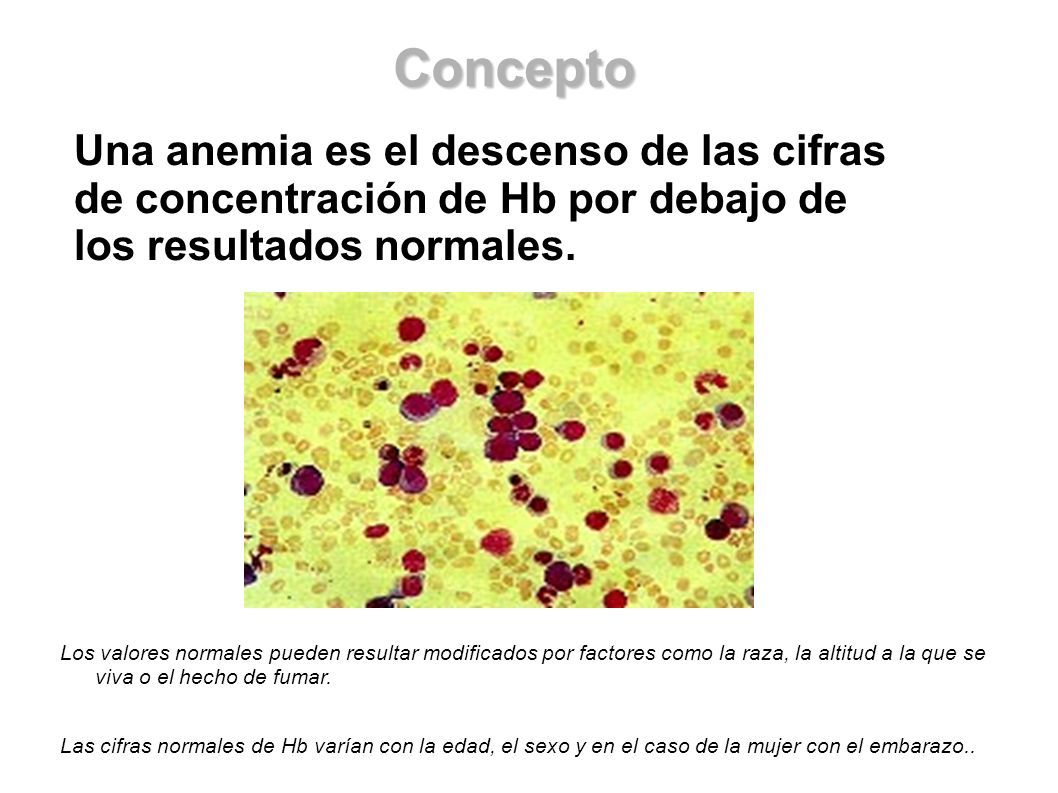 Concepto Una anemia es el descenso de las cifras de concentración de Hb por debajo de los resultados normales.