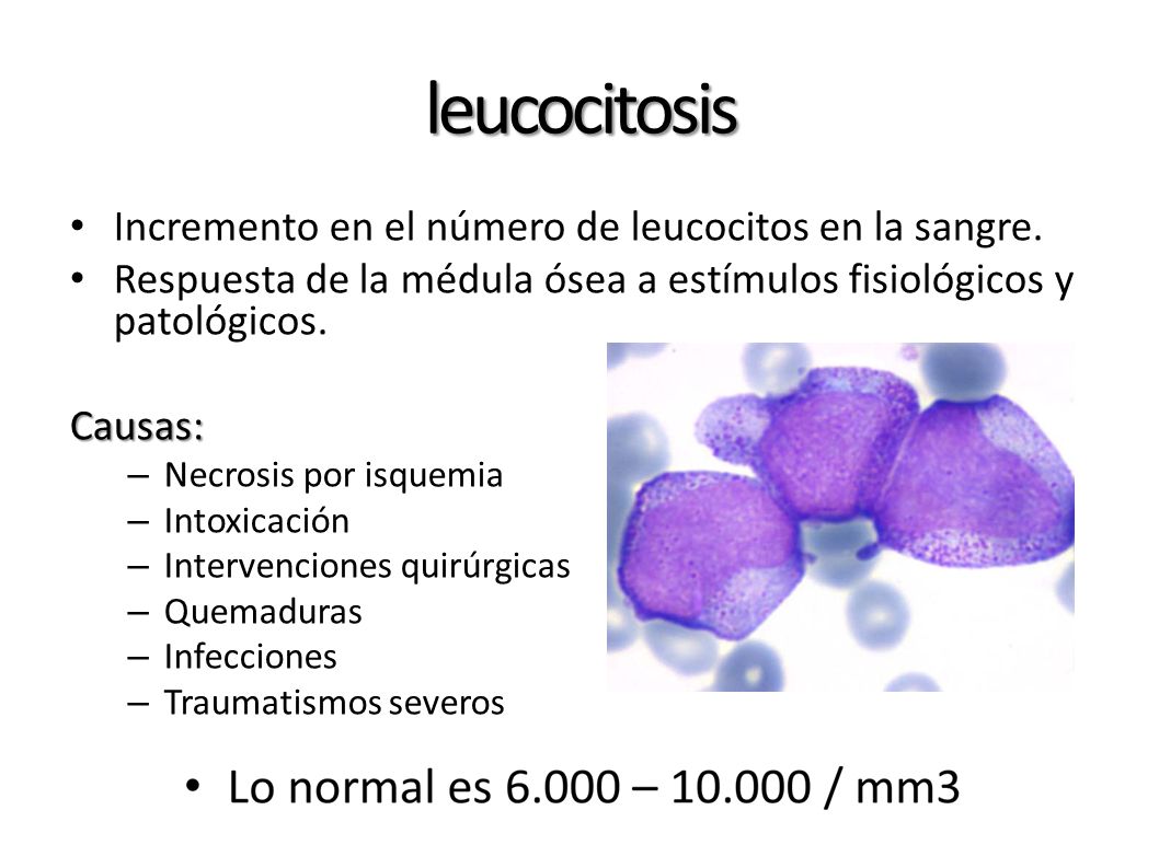 leucocitosis Incremento en el número de leucocitos en la sangre.